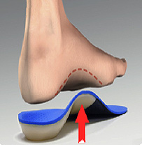 Orthotics | Bird Physical Therapy